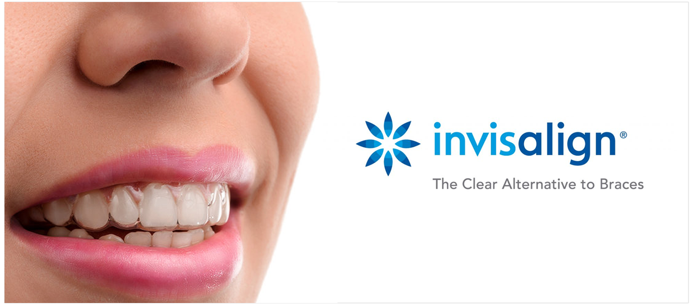 Invisalign technology available at Darnall Dental Clinic