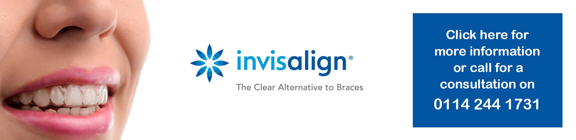 Invisalign Braces available at Darnall Dental Clinic